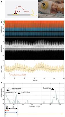 Low frequency cerebral arterial and venous flow oscillations in healthy neonates measured by NeoDoppler